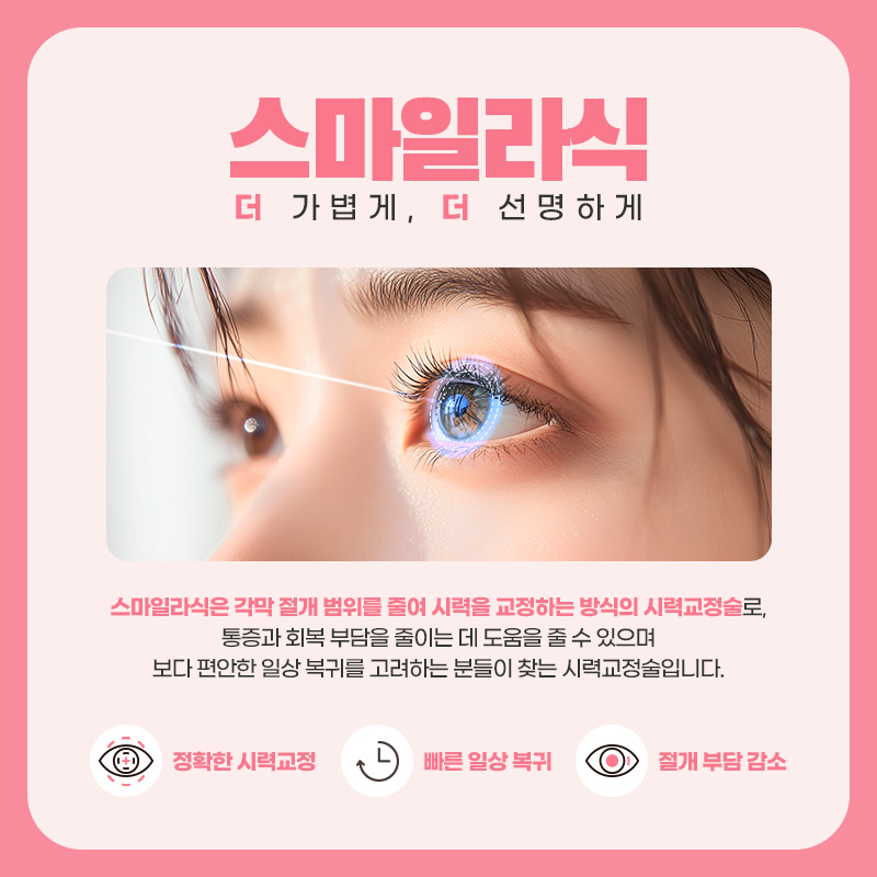 스마일라식 소개 그림