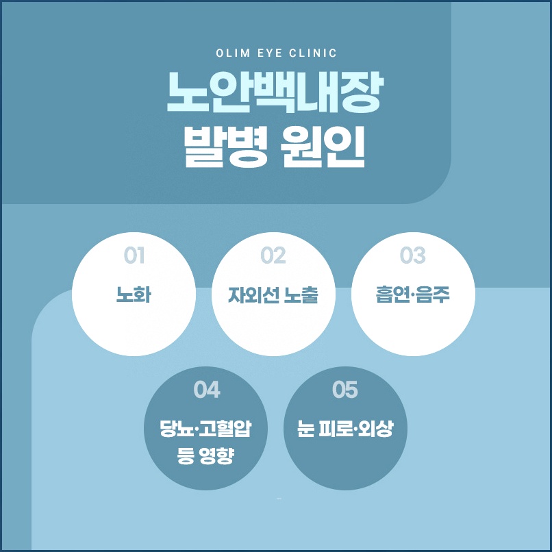 노안백내장 발병 원인 다섯 가지 안내 그림