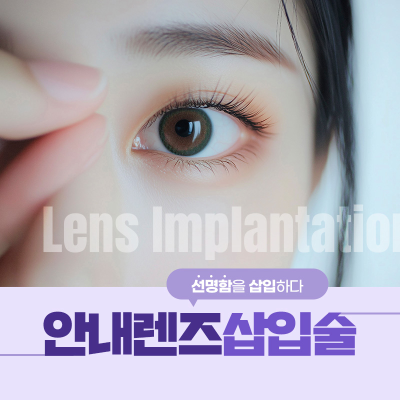 안내렌즈삽입술 안내 이미지