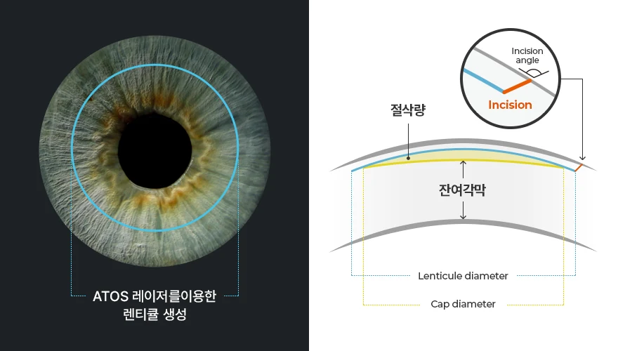 펨토초 레이저